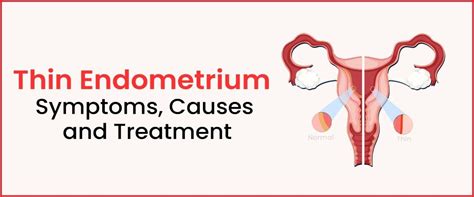 anteverted uterus with thin endometrium means|Understanding Thin Endometrium: Causes, Effects on Fertility, .